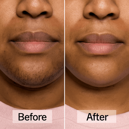 SilkAura™ Hair Trimmer